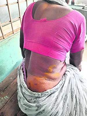 వృద్ధురాలిపై కోతుల దాడి