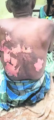 విద్యుదాఘాతంతో రైతుకు తీవ్రగాయాలు