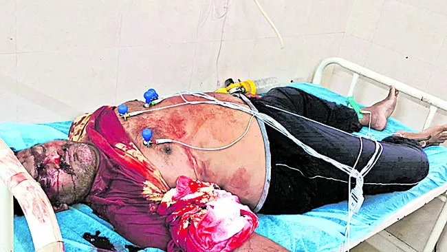 వేర్వ