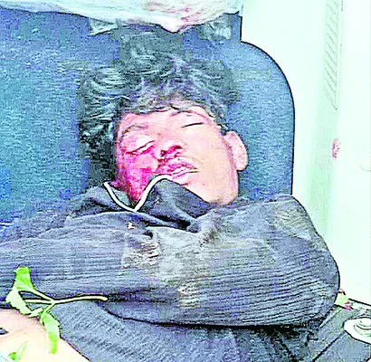 రోడ్డ