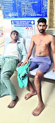 రైతులపై టీడీపీ నాయకుల దాడి
