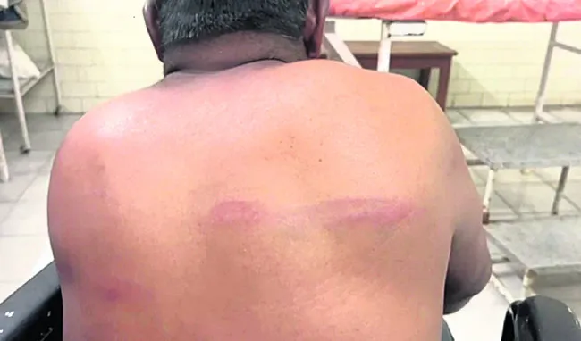 బస్టాండ్లో వ్యక్తిపై దాడి