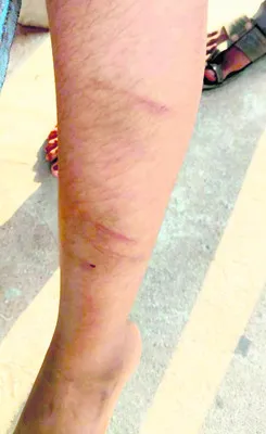 బాలికపై మేనమామ వేధింపులు