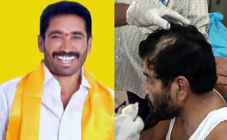 మాచర్లలో బరితెగించిన టీడీపీ గూండాలు.. జర్నలిస్ట్‌పై దాడి