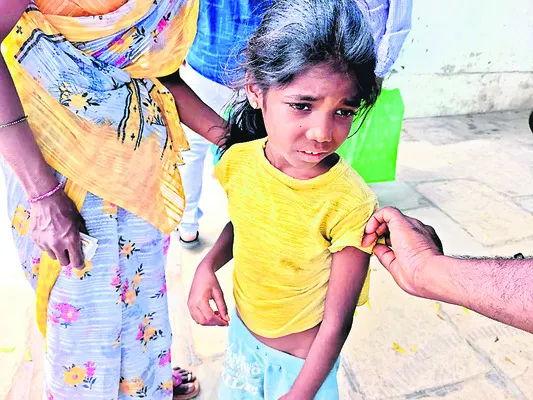 రెండేళ్ల పాపపై కుక్క దాడి