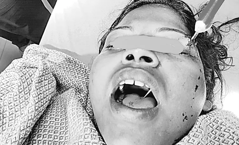 కంటిపై పొడిస్తే నోట్లోకొచ్చిన్ కత్తి!