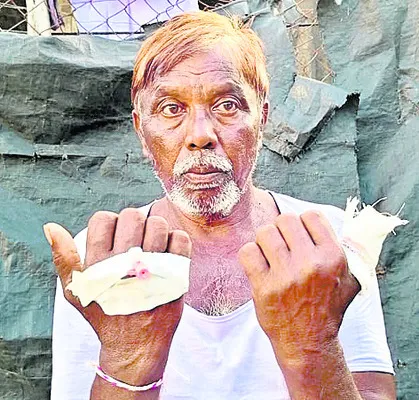 పిచ్చికుక్క దాడిలో  ఆరుగురికి గాయాలు