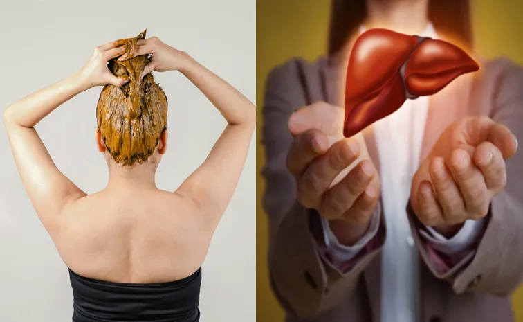 లివర్ సమస్యలకు హెన్నాతో చెక్?