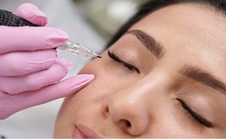 మచ్చ'లిక' మాయం