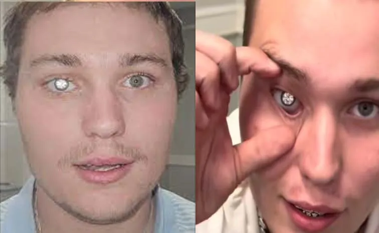 Slater Jones has fitted his artificial eye with a two carat diamond