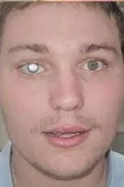 Slater Jones has fitted his artificial eye with a two carat diamond10