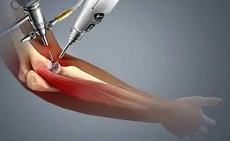 Manipal Hospitals record of successful re joint Elbow surgery