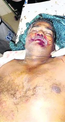 రోడ్డు ప్రమాదంలో పొగాకు రైతు మృతి 