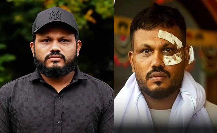 Air India survivor: ఆ రోజు అతను బతకడం ఓ అద్భుతం..కానీ ఇప్పుడు ప్రతిక్షణం..