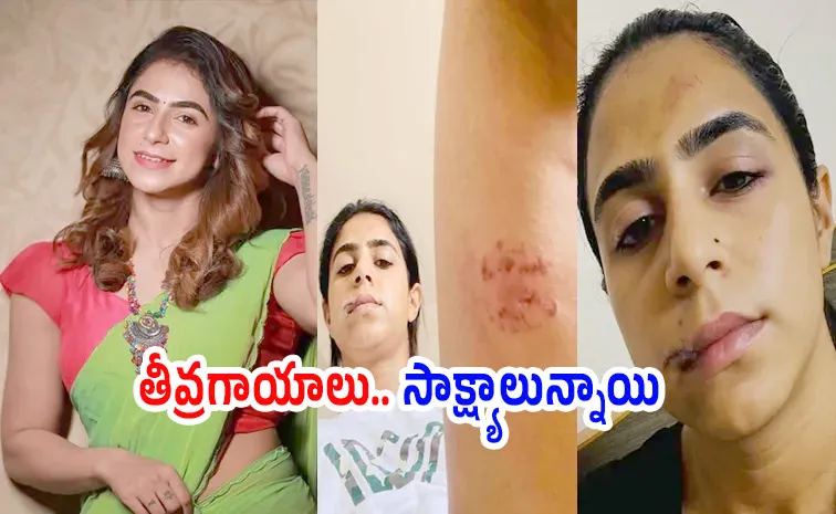 జుట్టు పట్టి నేలకేసి కొట్టాడు.. ఆ రాక్షసుడి వల్ల డిప్రెషన్‌లో.. నటి కన్నీటిగాథ