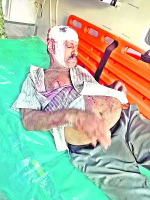 బెల్టుషాప్‌ నిర్వాహకుడిపై కత్తితో దాడి