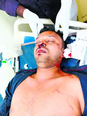 రోడ్డు ప్రమాదంలో  యువకుడికి తీవ్ర గాయాలు 