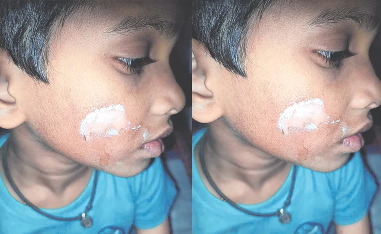 చిన్నారిపై ట్యూషన్‌ టీచర్‌ దాష్టీకం 