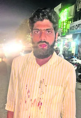 వ్యక్తిపై కార్పొరేటర్‌ మూర్తియాదవ్‌ అనుచరుడి దాడి? 