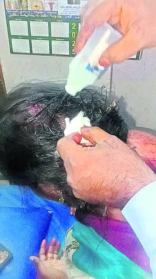 ఆసుపత్రి కమిటీ సభ్యురాలిపై తెలుగు తమ్ముళ్ల దాడి 