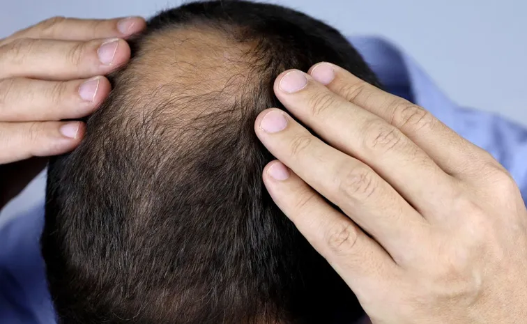 When I went to the clinic because of hair loss