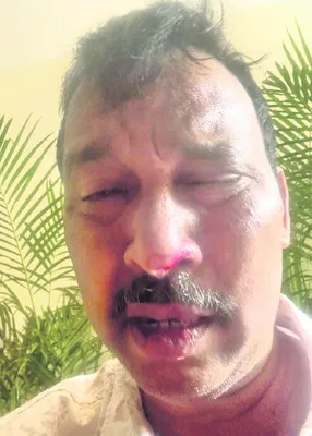 పెప్పర్‌ స్ప్రే కొట్టి భర్తపై భార్య దాడి 