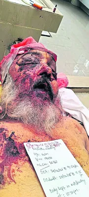 కారు, లారీ ఢీకొని ఒకరి మృతి