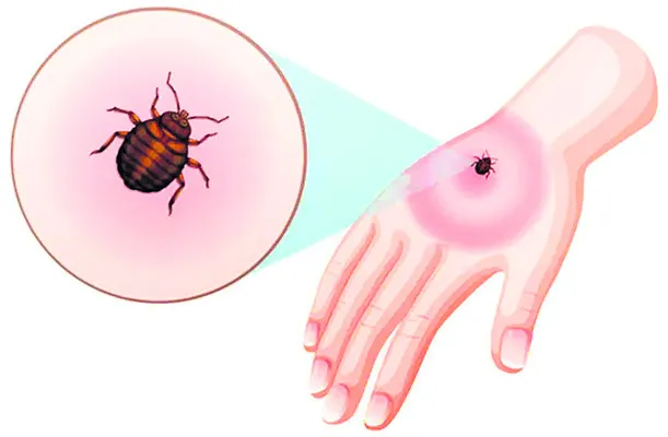 బాబోయ్‌ పురుగు!