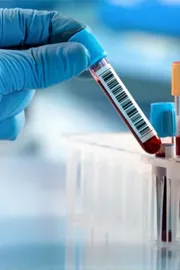 ICMR developing multiplex molecular diagnostic test