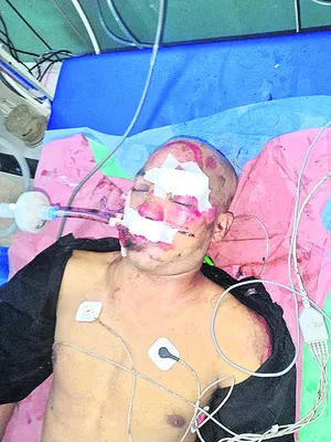 రోడ్డు ప్రమాదంలో వలస కార్మికుడి మృతి