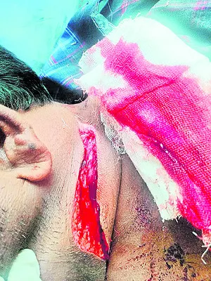 కోడి పందేల బరి వద్ద బ్లేడ్‌తో దాడి 