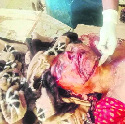 వాహనం ఢీకొని గుర్తుతెలియని మహిళ మృతి