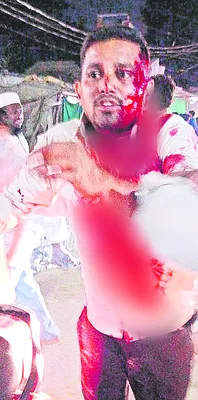 ఘర్షణలో కొడవలితో దాడి 