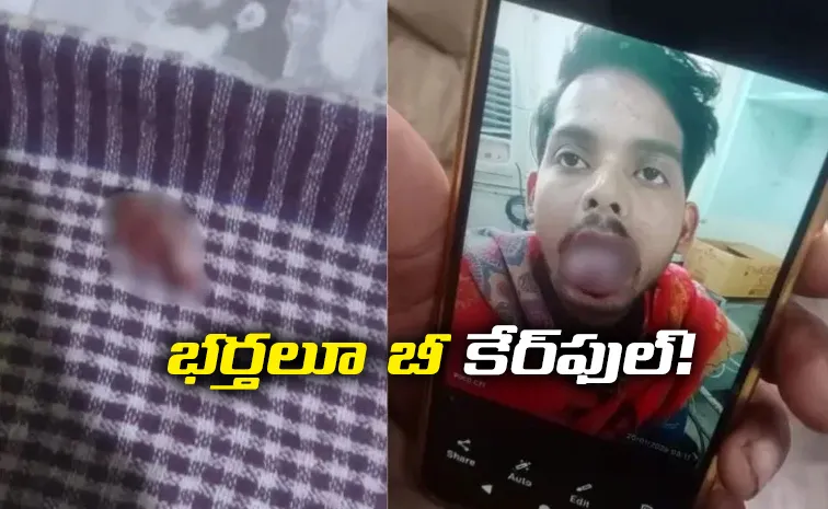 Newlywed woman bites off husband's tongue in Ghaziabad after dispute over cooking arrested