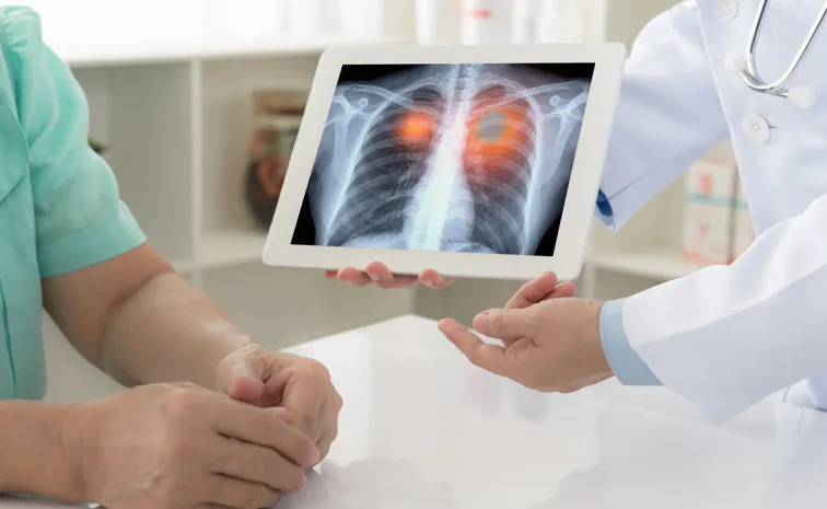 Health Tips: Rising lung cancer cases which is the optimal choice