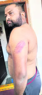 బీఆర్‌ఎస్‌ కార్యకర్తపై కాంగ్రెస్‌ నేతల దాడి