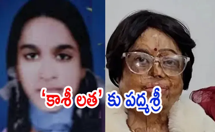 తొలి యాసిడ్‌ బాధితురాలు, చచ్చిపోదామనుకుంది.. ఇపుడు పద్మశ్రీ! 