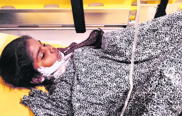 అగ్ని ప్రమాదంలో గాయపడిన బాలిక మృతి 