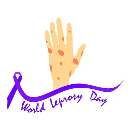 ‘కుష్టు వ్యాధి’ నయమవుతుంది!