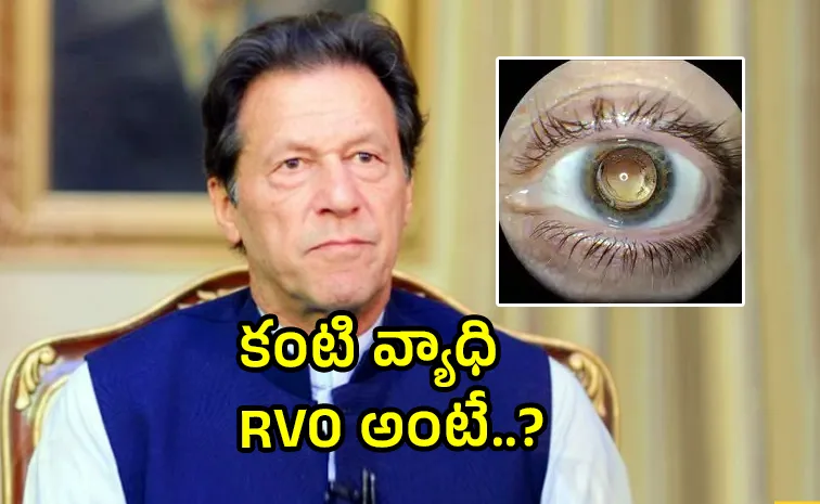 Imran Khan Underwent Procedure For Retinal Vein Occlusion