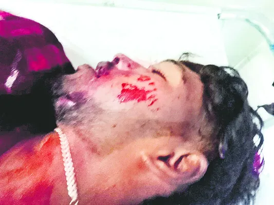 రోడ్డు ప్రమాదంలో విద్యార్థి దుర్మరణం 