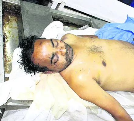 చికిత్స పొందుతూ లోకో పైలెట్‌ మృతి