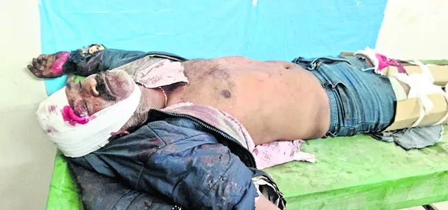 రోడ్డు ప్రమాదంలో  ఆటో డ్రైవర్‌కు తీవ్ర గాయాలు   