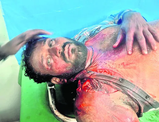 రోడ్డు ప్రమాదంలో సుమో డ్రైవర్‌కు తీవ్ర గాయాలు