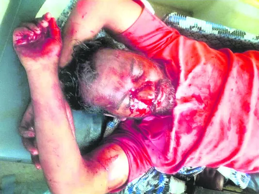 తమ్ముడిపై అన్న గొడ్డలితో దాడి 