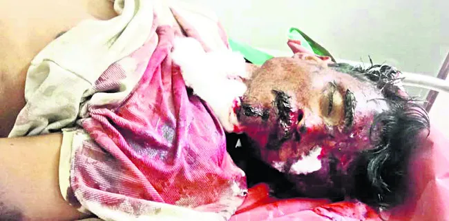 వాహనం ఢీకొని గుర్తు తెలియని వ్యక్తి మృతి