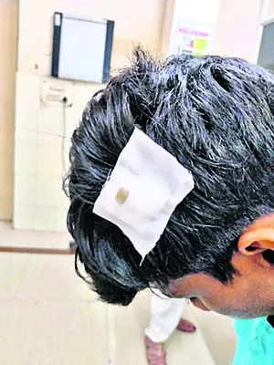 అల్లరి చేశాడని తల పగలకొట్టారు