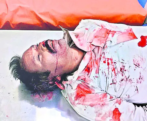 రోడ్డు ప్రమాదంలో  వ్యక్తికి గాయాలు 