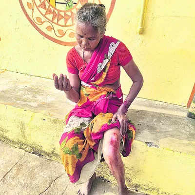 మహిళపై అడవిపంది దాడి