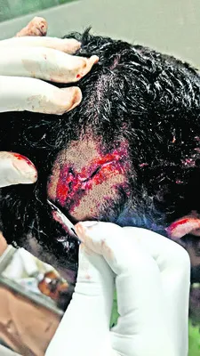 తమ్ముళ్ల తన్నులాట.. 